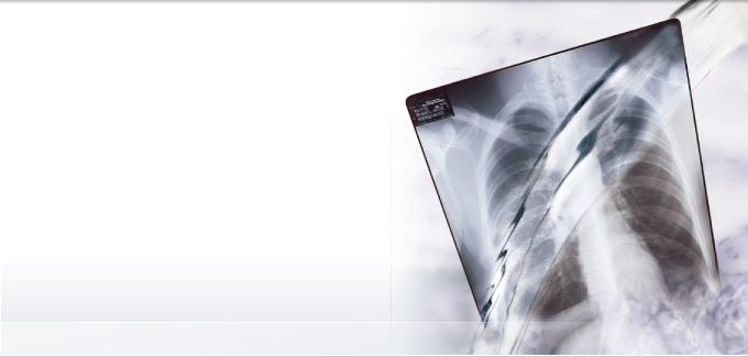 Medical X-Ray Developer and Replenisher