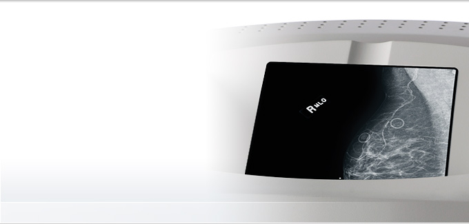 DRYVIEW Mammography Laser Imaging Film