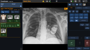 Carestream ImageView Software Platform