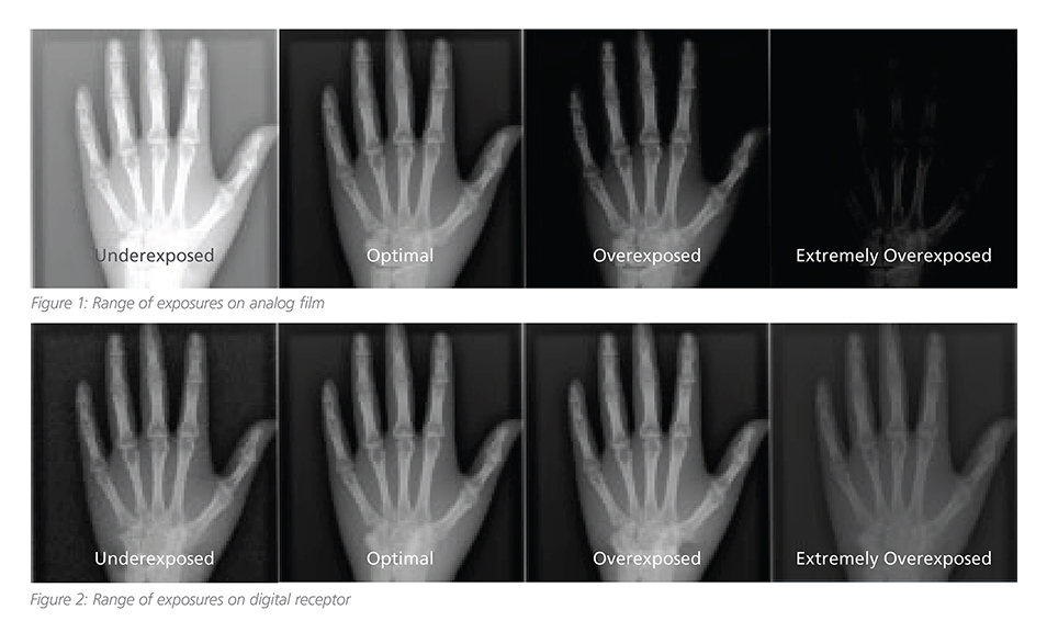 Exposure Indices, Dose, and Image Quality