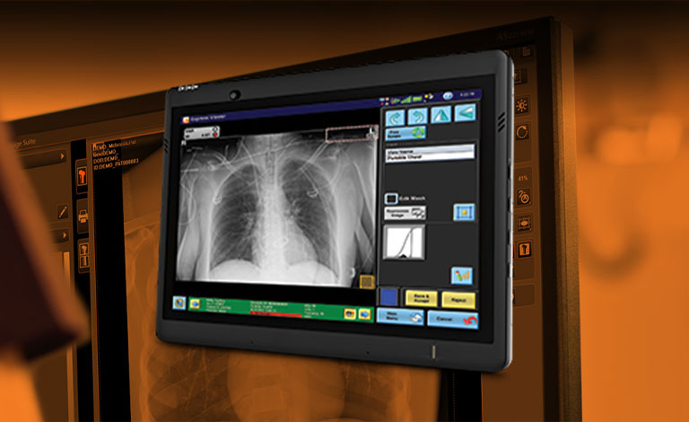 Carestream Introduces New Software Update to Boost Diagnostic Accuracy