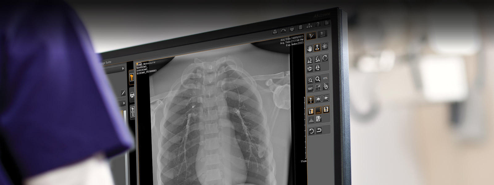 Software Image Suite de Carestream