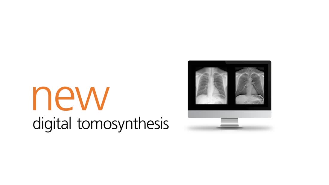 Eclipse - What's New? Dual Energy & Digital Tomosynthesis Eclipse - What's New? Dual Energy & Digital Tomosynthesis
