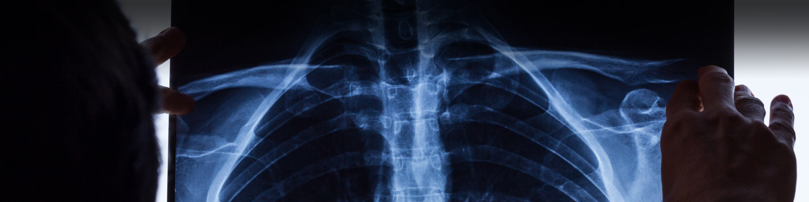 Films de radiologie Carestream