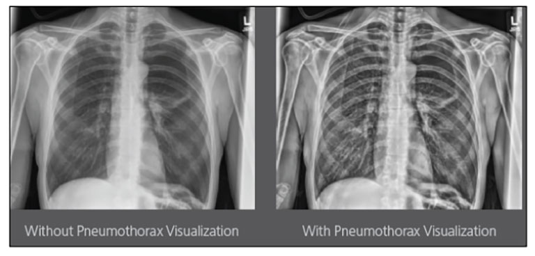 Simple and Effective Design