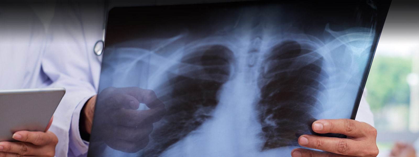 Sistemas de impressão Carestream