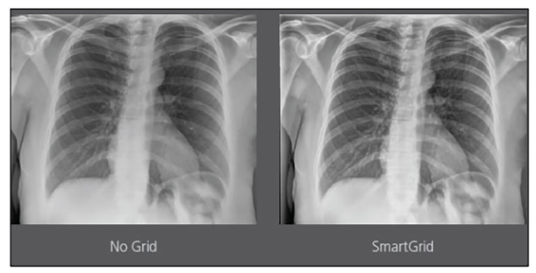 Simple and Effective Design